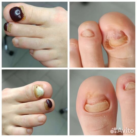 Маникюр и педикюр подолог