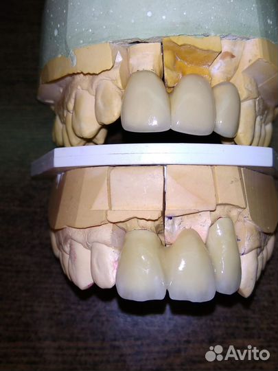 Услуги зубного техника