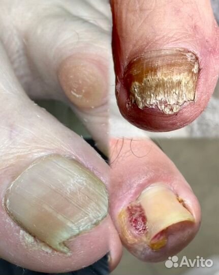 Услуги подолога