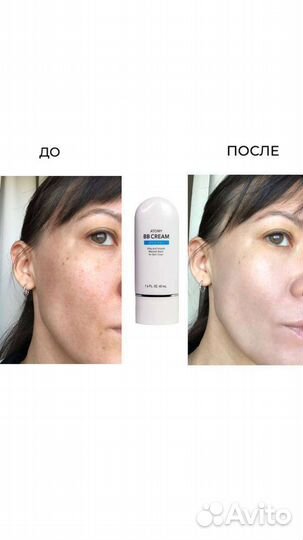 Вв крем Атоми