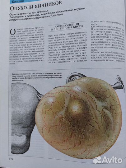 Медицинская энциклопедия, кардиология, неврология