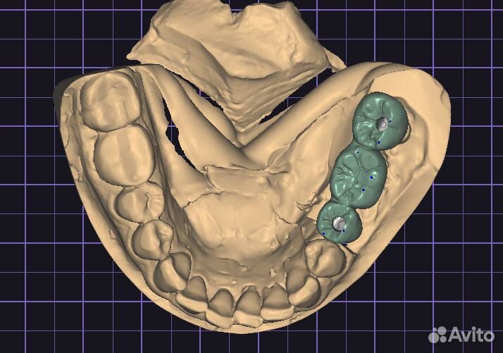 Моделировка в Exocad/Оператор cadcam