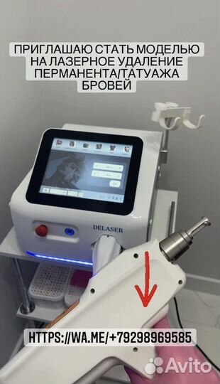 Лазерное удаление татуажа