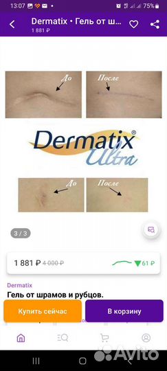 Dermatix. Гель от шрамов и рубцов