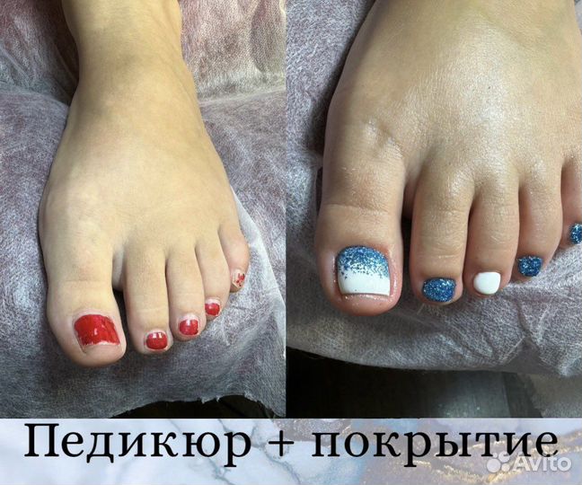 Педикюр, подология