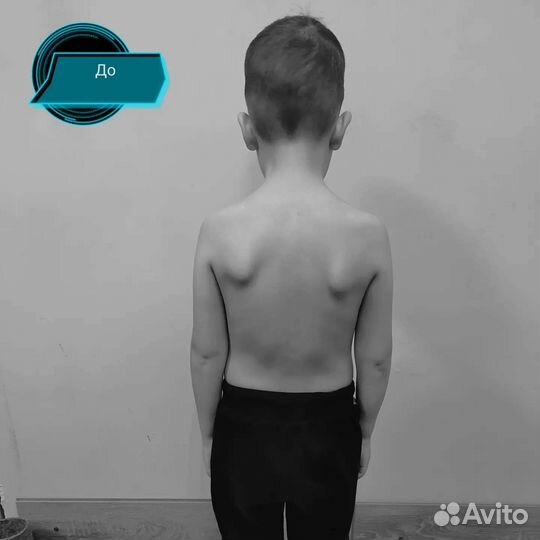 Массаж Оздоровительный - Костоправие