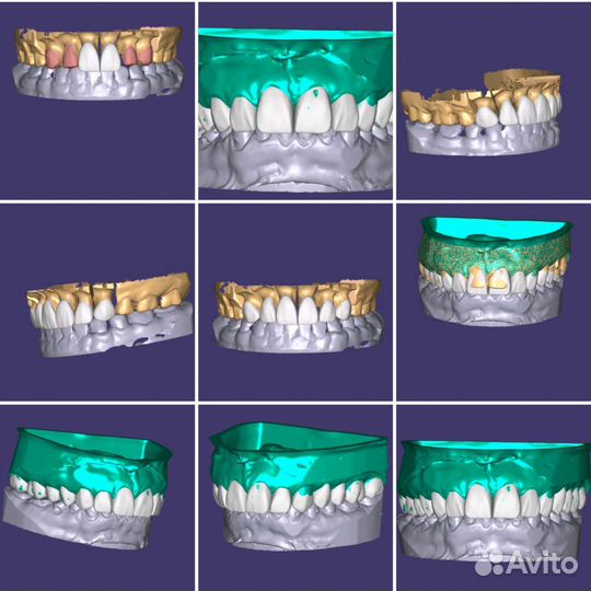 Зубоной техник