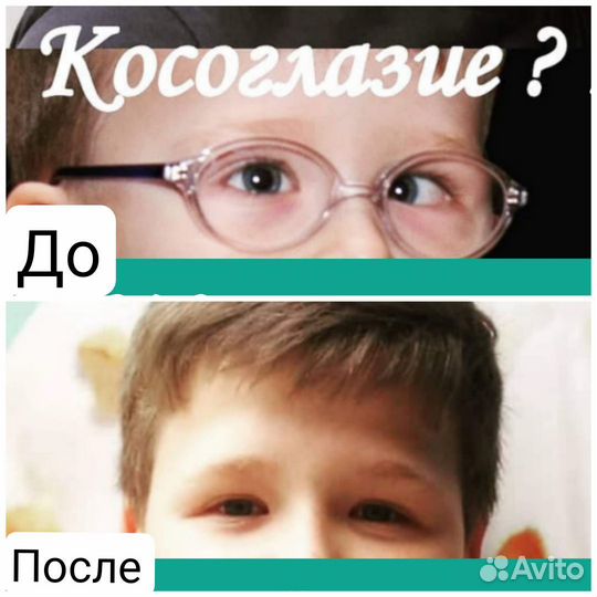 Кинезиомассаж