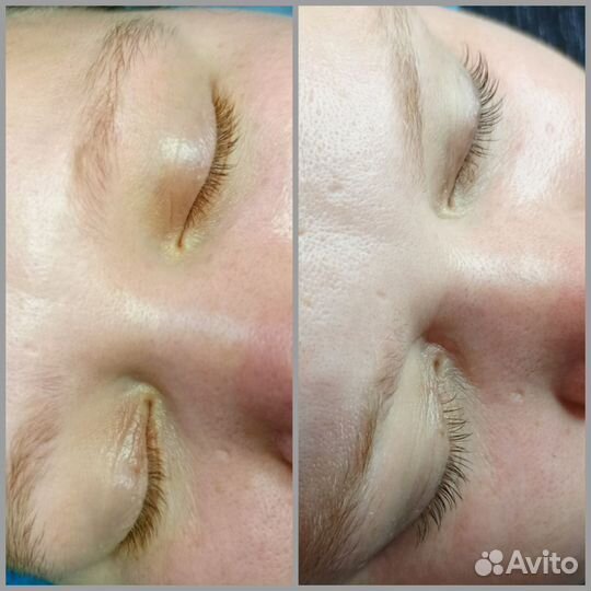 Ламинирование ресниц