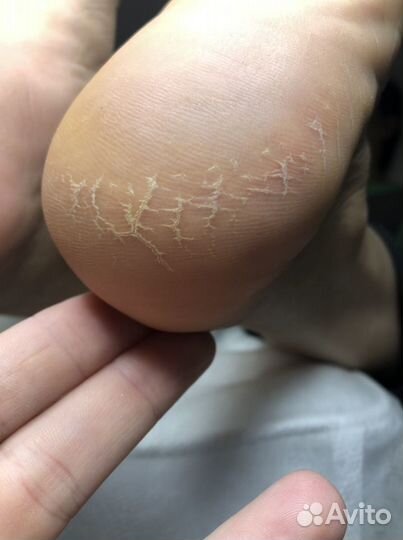 Маникюр и педикюр(смарт педикюр)