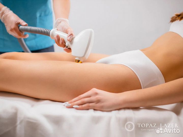 Topaz lazer - франшиза в сфере косметологии