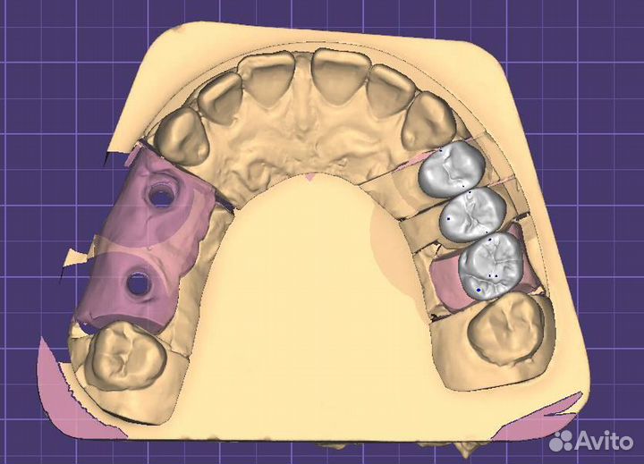 Моделировка в Exocad/Оператор cadcam