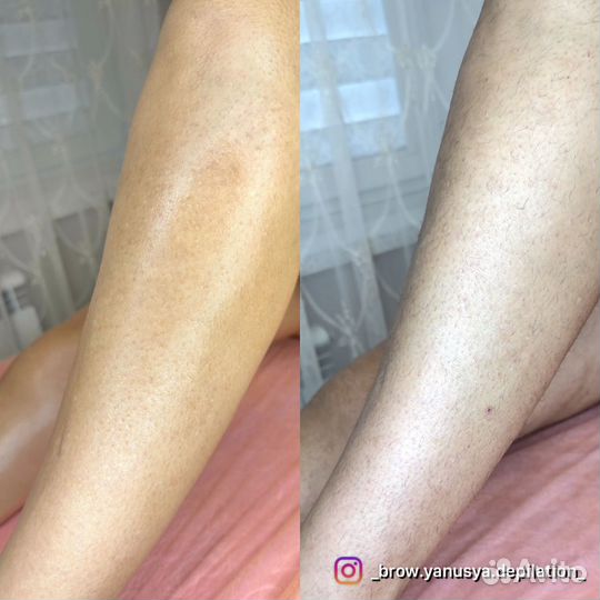 Нужны модели/Восковая депиляция