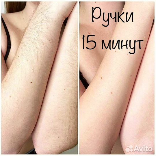 Депиляция воском: глубокое бикини