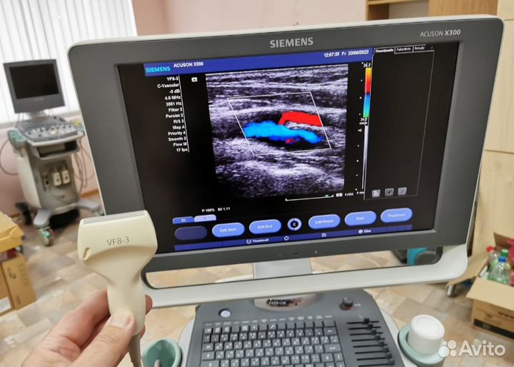 Аренда узи аппарата