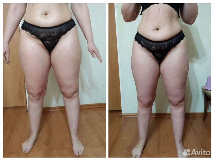 Медицинский массаж. Антицеллюлитный массаж