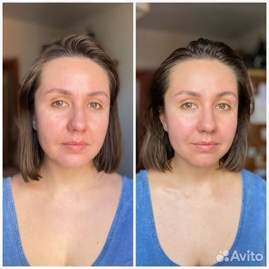 Массаж лица