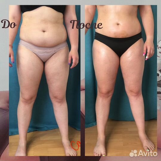 Вакуумный массаж