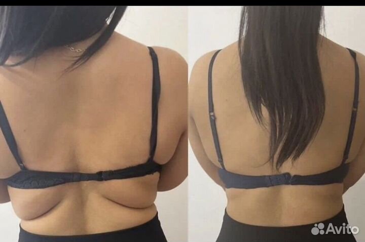 Липолитики