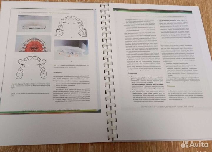 Книга Ортодонтические ретейнеры и съемные аппараты