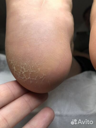 Маникюр и педикюр(смарт педикюр)