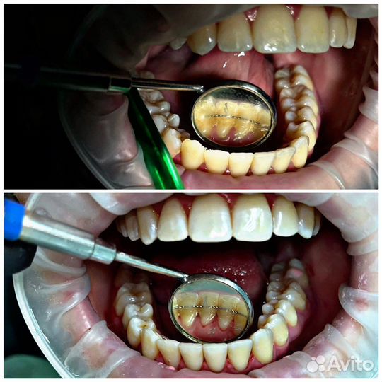 Гигиенист стоматологический