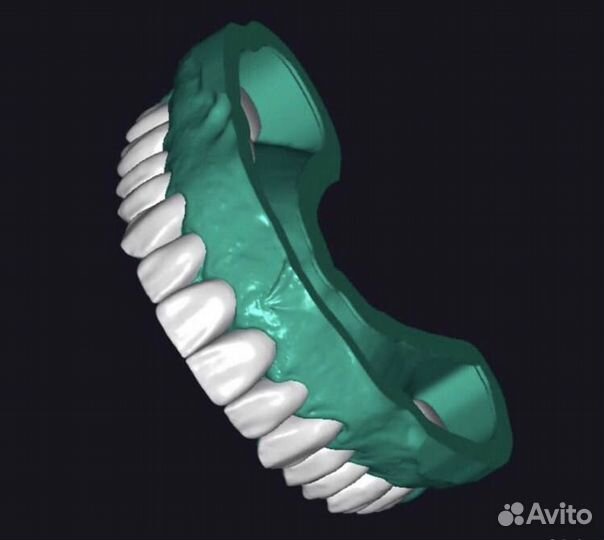 Моделировка в Exocad/Оператор cadcam