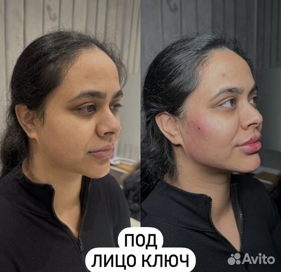 Full Face / Лицо под ключ