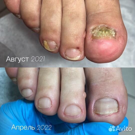 Кабинет педикюра, подолог Лобня