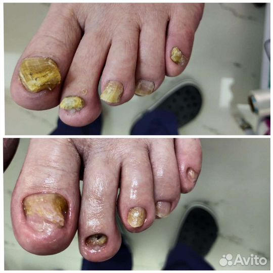 Подолог. Маникюр. Педикюр. Студия Нины Федоровой