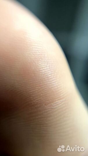 Аппаратный педикюр