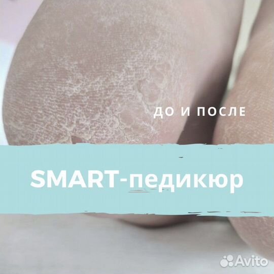 Smart, подосмарт педикюр, педикюр