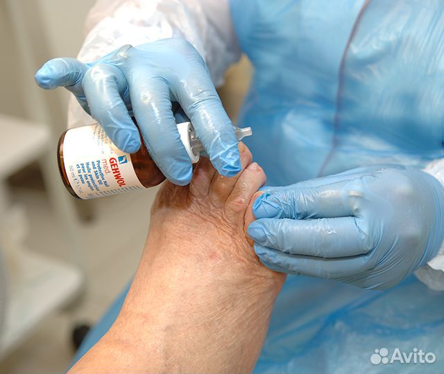 Лечебный педикюр, грибок ногтей