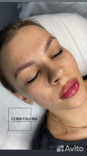 Увеличение губ модель