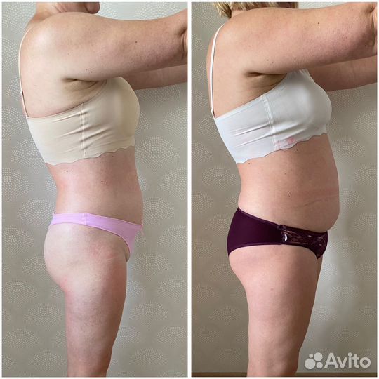 Аппаратный массаж, коррекция тела