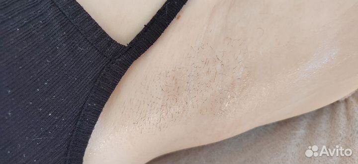 Восковая депиляция