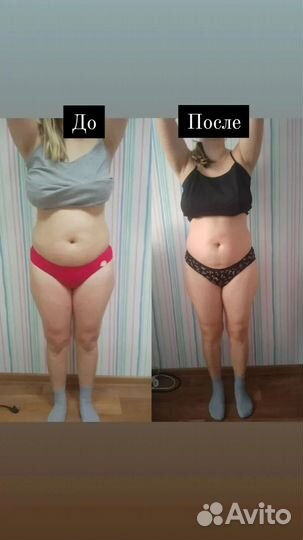 Массаж антицеллюлитный