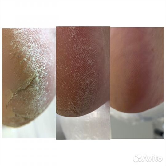 Услуги подолога