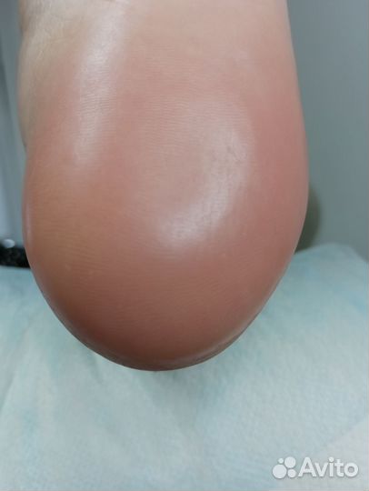 Смарт педикюр