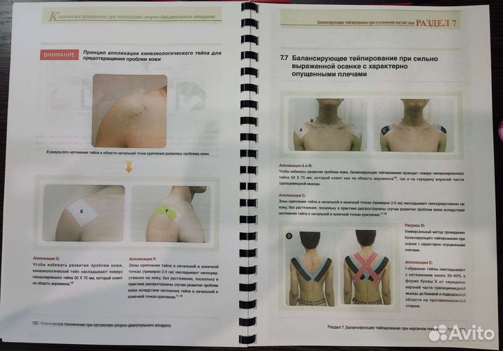 Балансирующее тейпирование