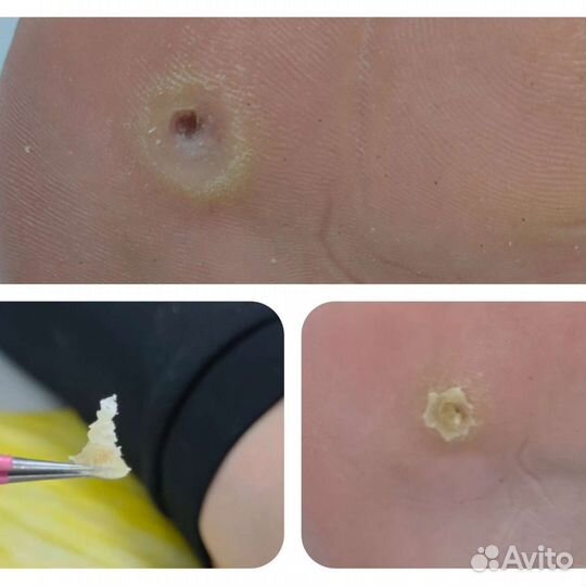 Подолог,педикюр