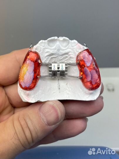 Зубной техник ортодонт