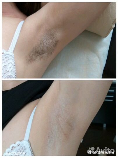 Косметолог эстетист/ Ленинский /Пр.Героев /Спб