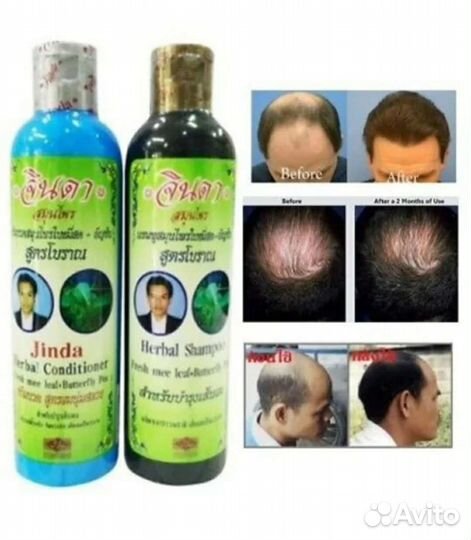Лечебный комплекс от выпадения волос Jinda