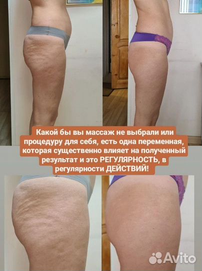 Ищу модель для коррекции фигуры