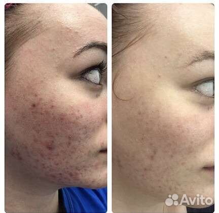 Бровки, реснички, депиляция, косметолог