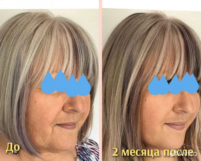 Подбородок, овал лица