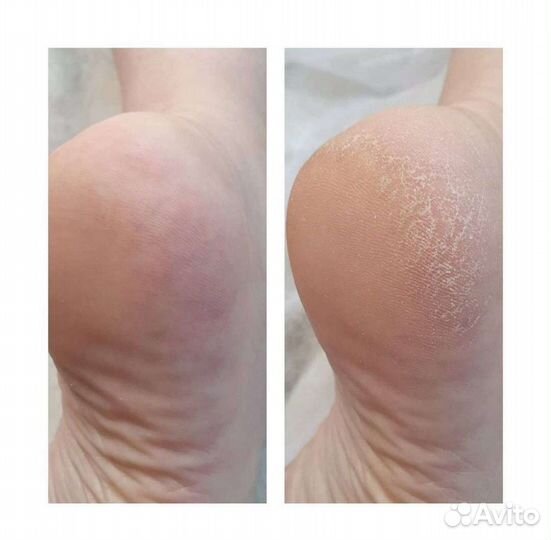 Маникюр,педикюр