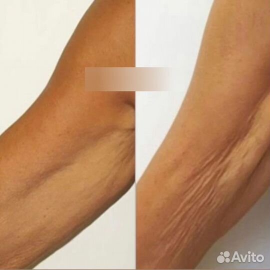 Холодная Плазма