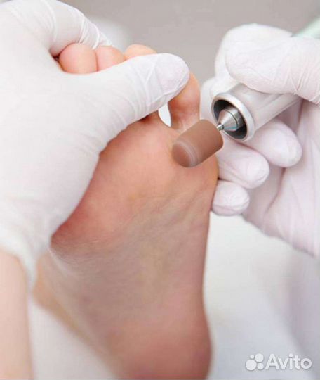 Медицинский педикюр